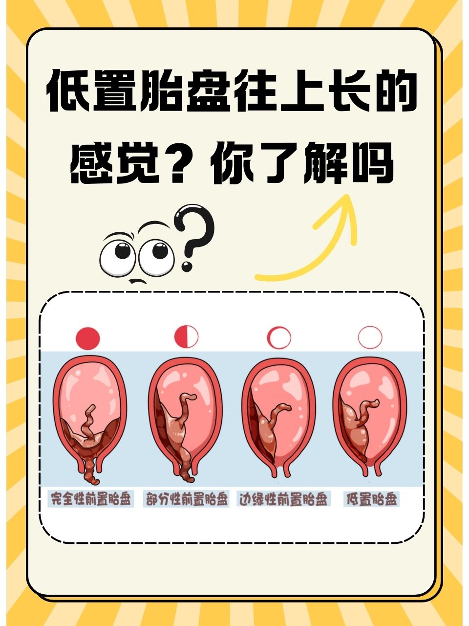 低置胎盘往上长的感觉?