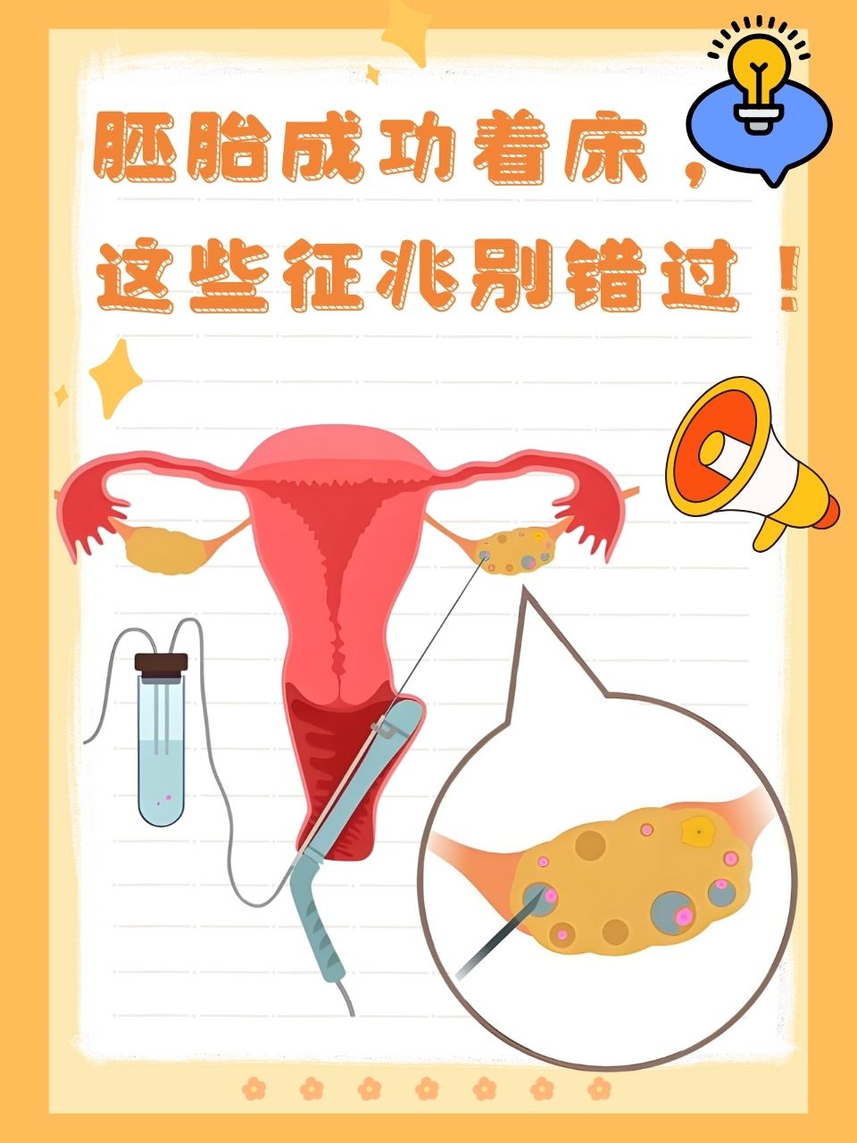 胚胎移植后要注意什么_胚胎移植后,要注意什么才能保证万无一失?