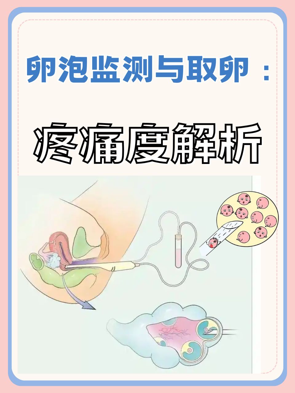 女孩取卵子_女孩子取卵会怎么样  第2张
