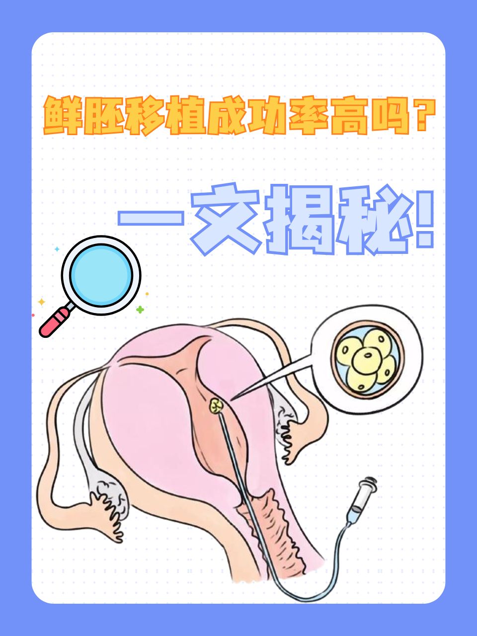 囊胚移植成功率高吗?(二级囊胚移植成功率高吗)