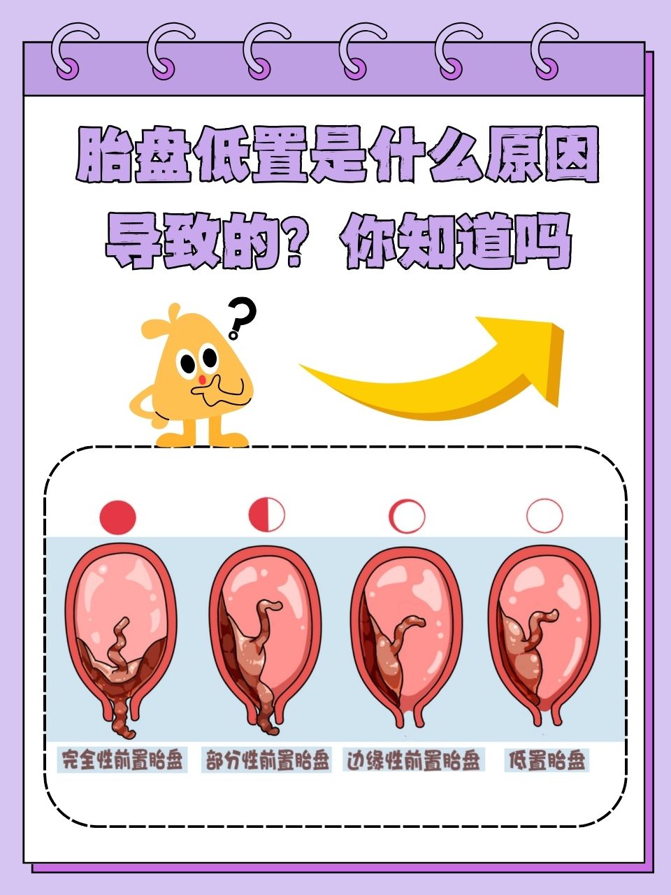 你知道吗  在孕期,胎盘低置是许多准妈妈关心的问题