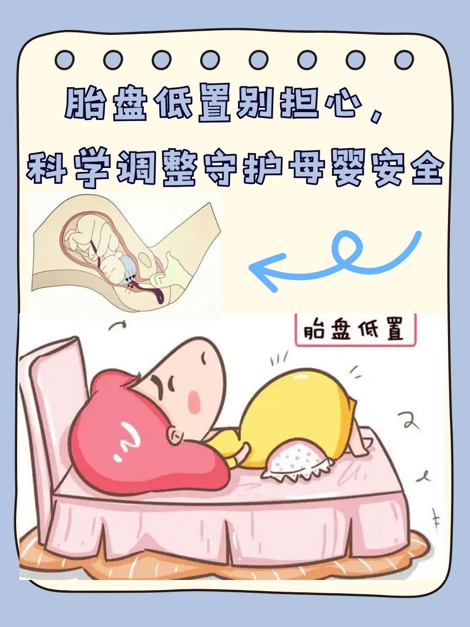 胎盘低置别担心,科学调整守护母婴安全