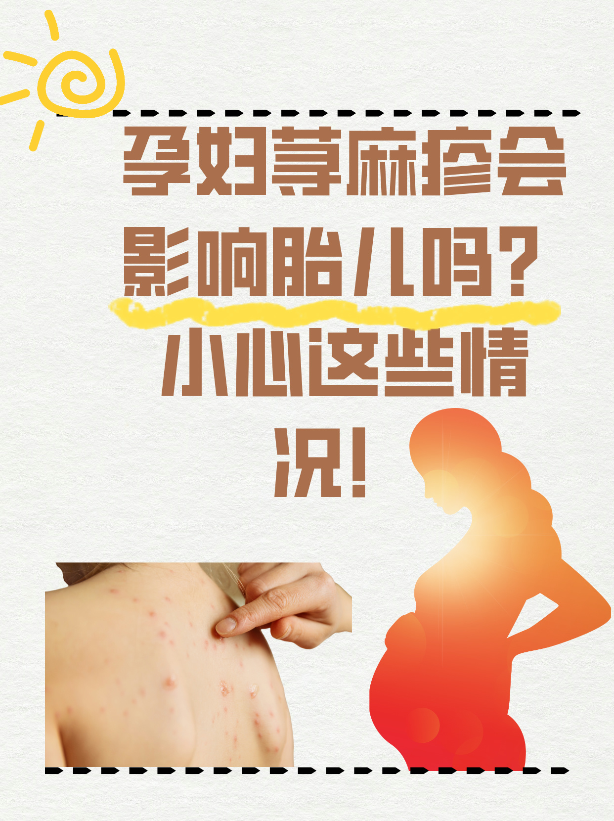 了解这些对于每位准孕期荨麻疹孕妇身上起红疙瘩很痒怎么办孕妇荨麻疹