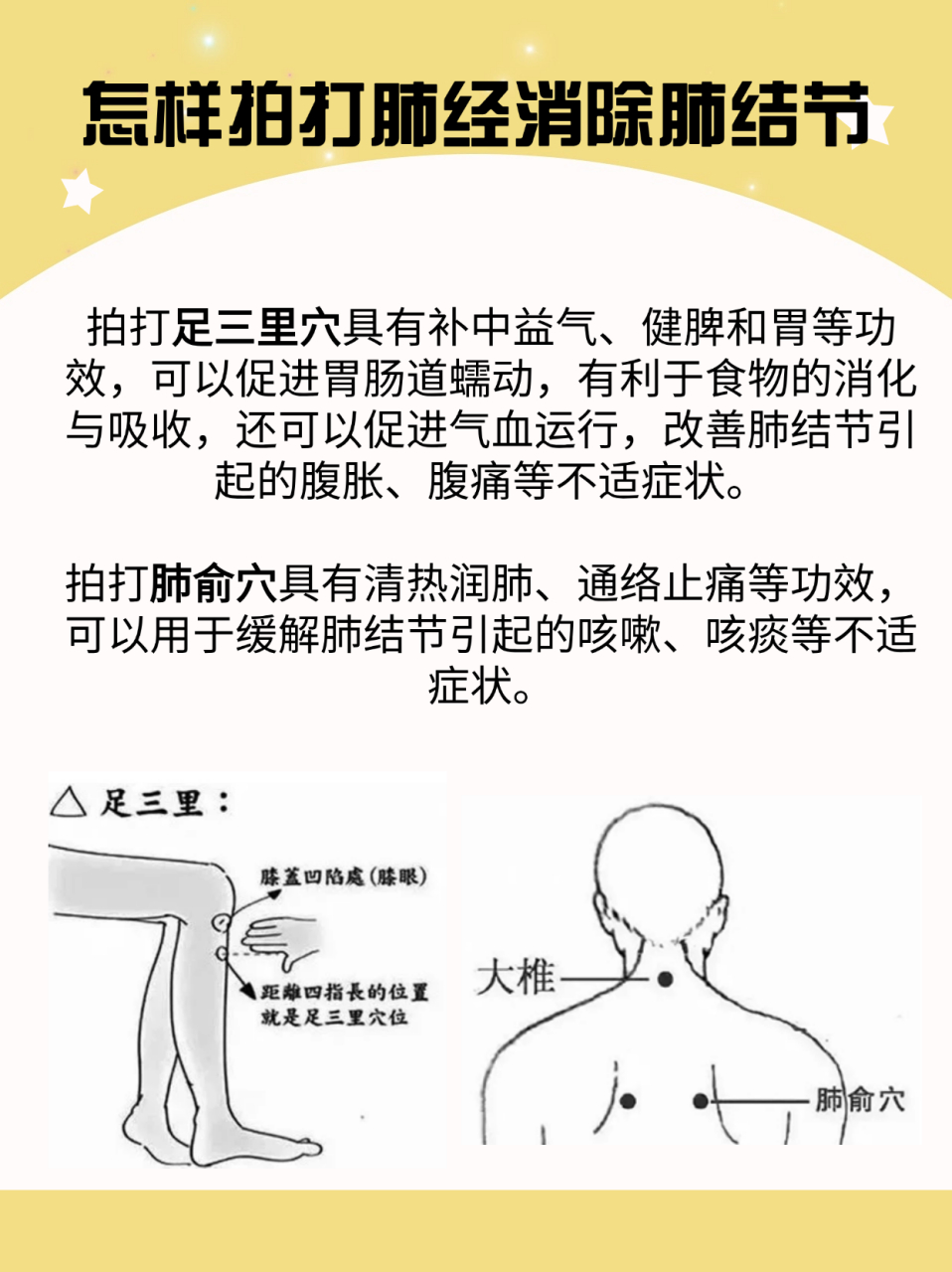 肺部健康新策略:专家教你如何通过拍打消除肺结节肺结节是一种较为