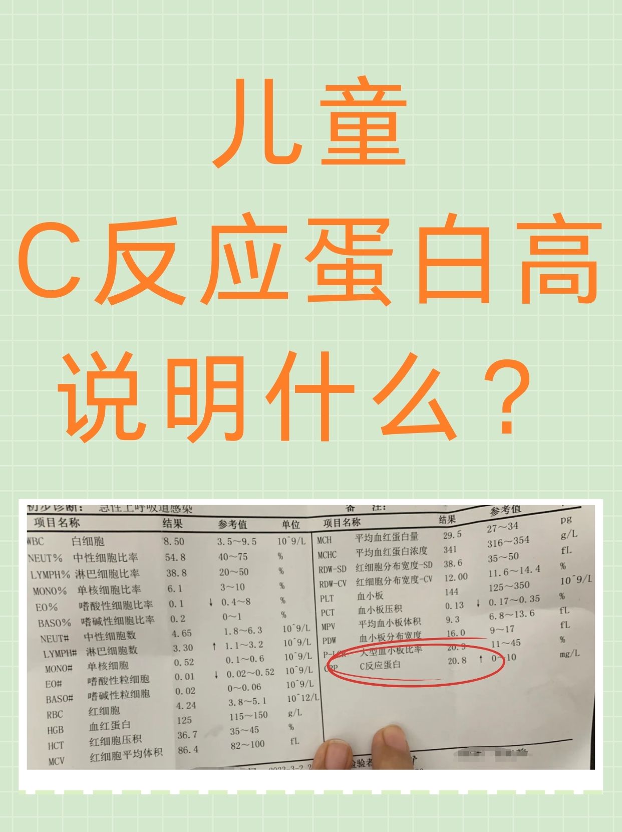 儿童c反应蛋白高说明什么 在儿童的体检或生病检查中,常常会看到一项