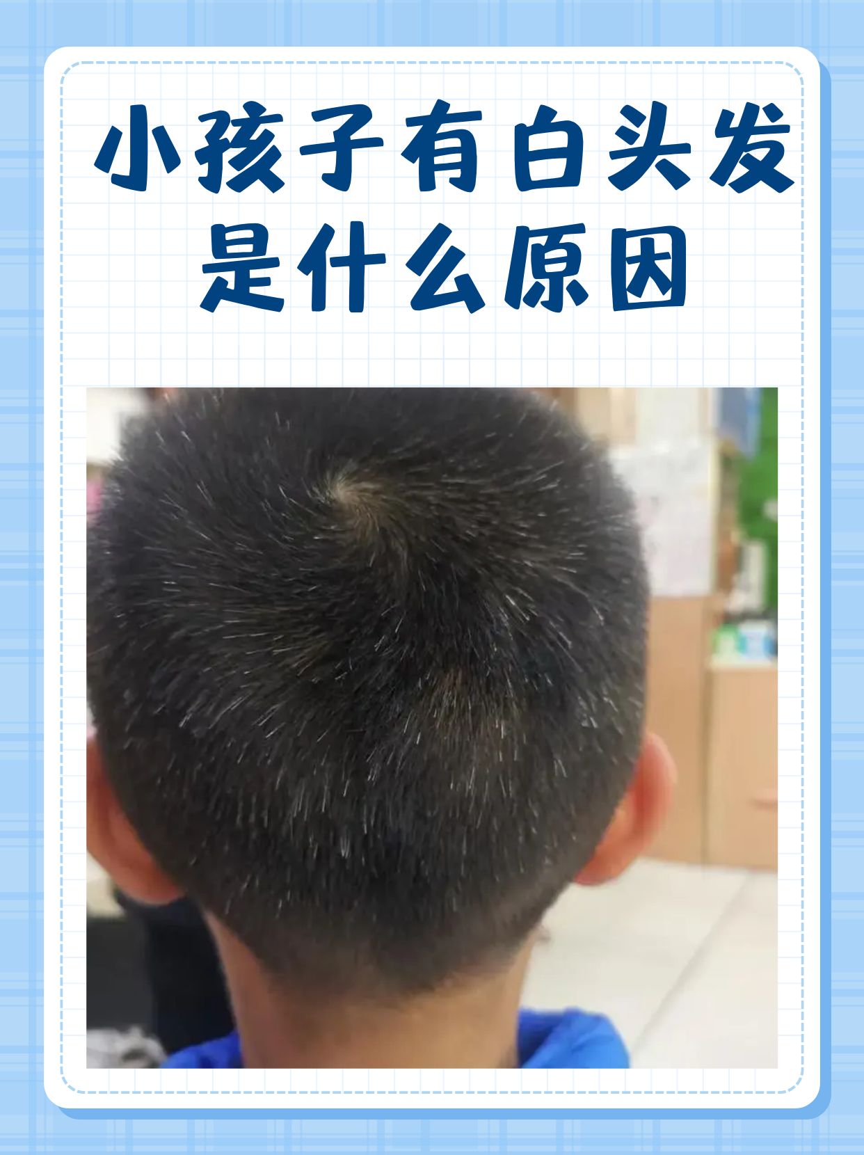 小孩子有白头发是什么原因?