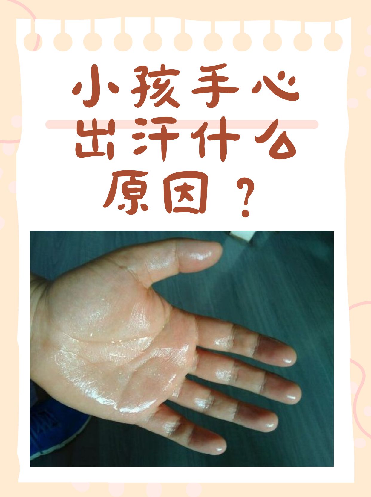 小孩手心出汗什么原因?