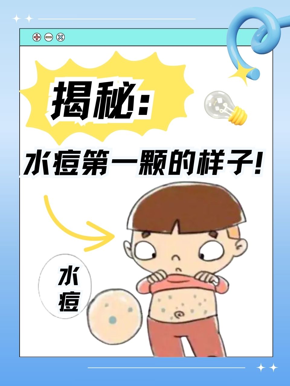 揭秘:水痘第一颗的样子!
