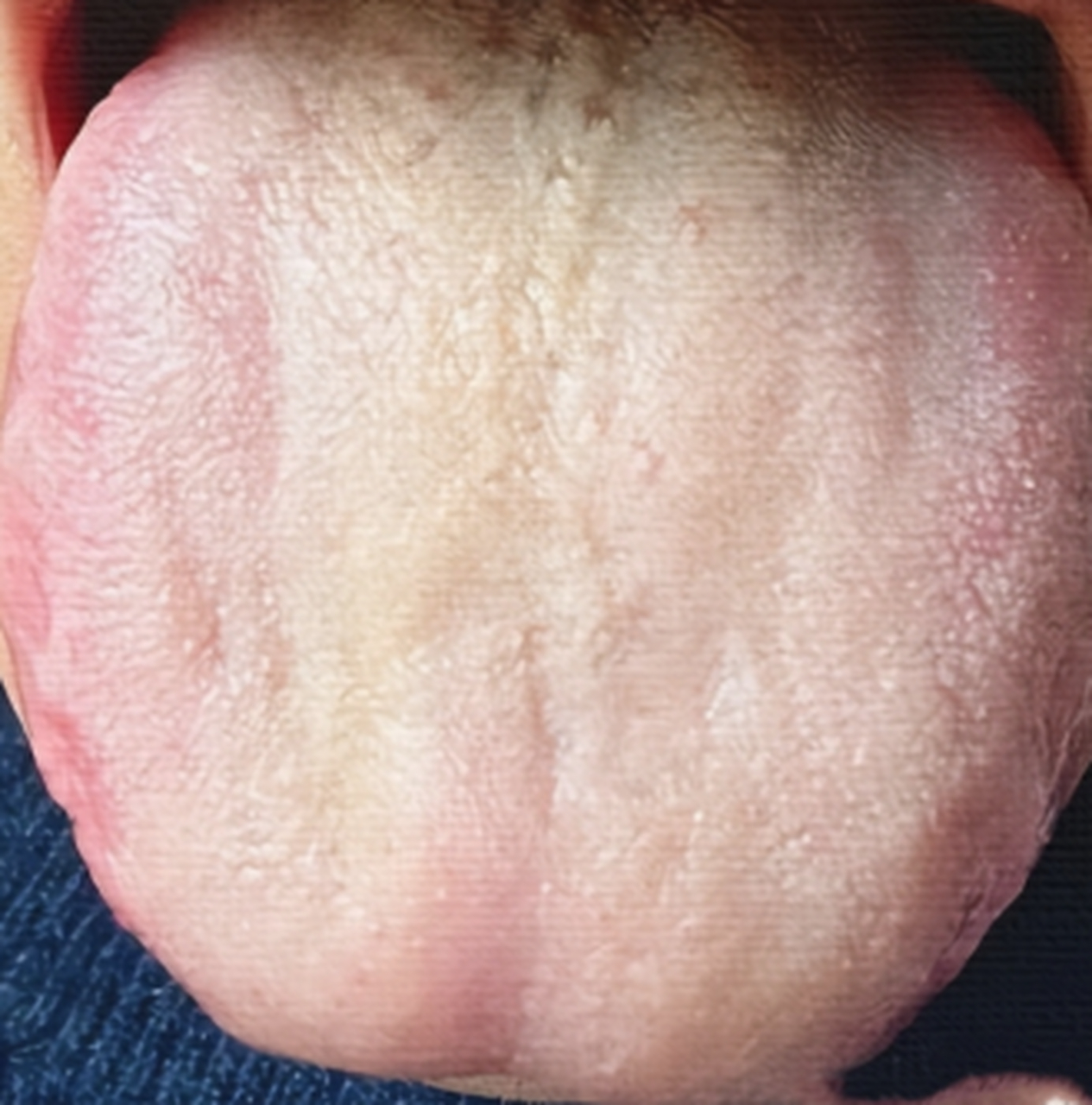 这舌头上的厚腻苔,一看就是脾肾阳虚了,一招教你重回巅峰!