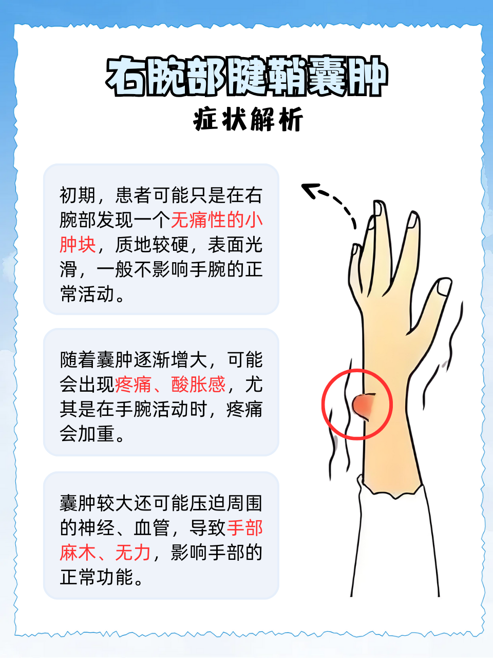 右腕腱鞘囊肿,这些治疗方法你试过没?