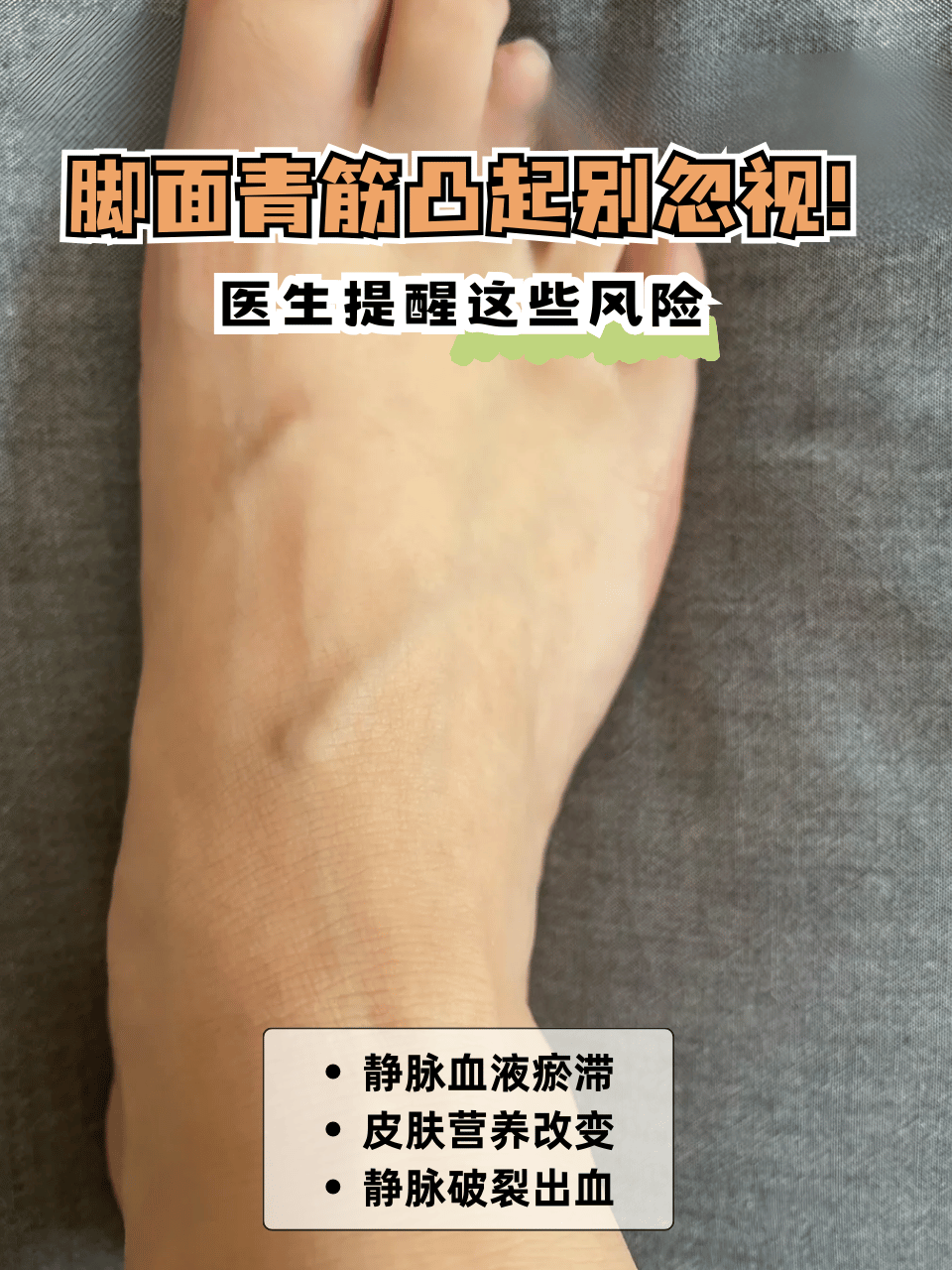 可能的风险 静脉血液瘀滞 脚面青筋凸起致静脉血流不畅