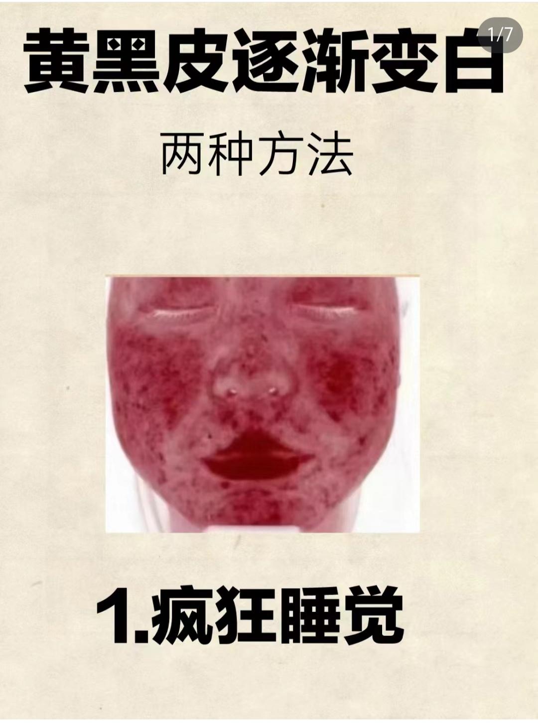 为什么有些人很容易晒黑为什么在线 为什么有些人很容易晒黑为什么在线