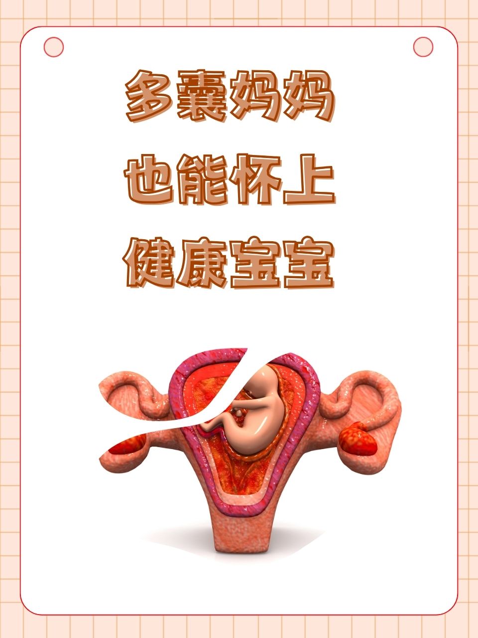 多卵巢可以自然怀孕吗_多卵巢卵综合症可以怀孕吗