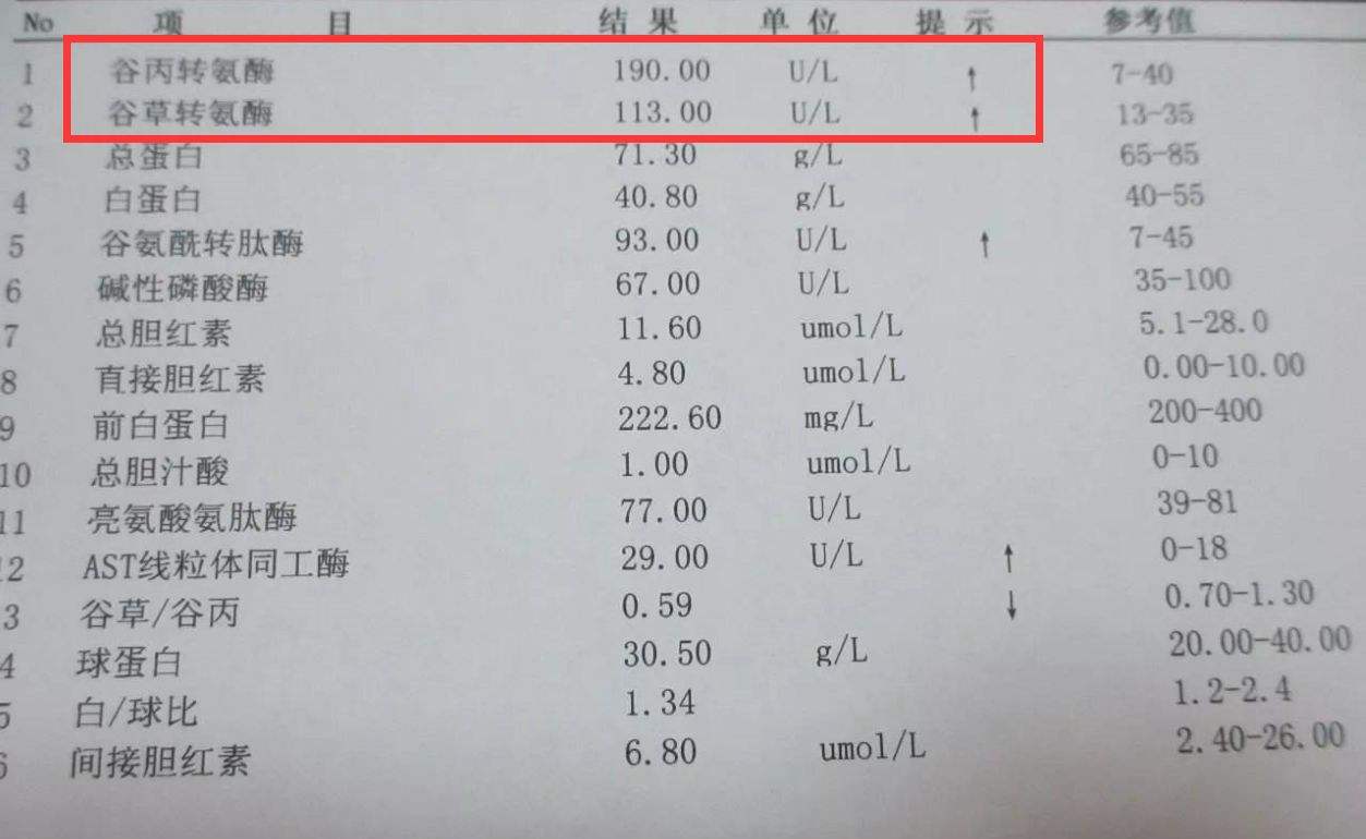 转氨酶是存在于人体细胞中的一种酶类,主要负责催化氨基酸与酮酸之间