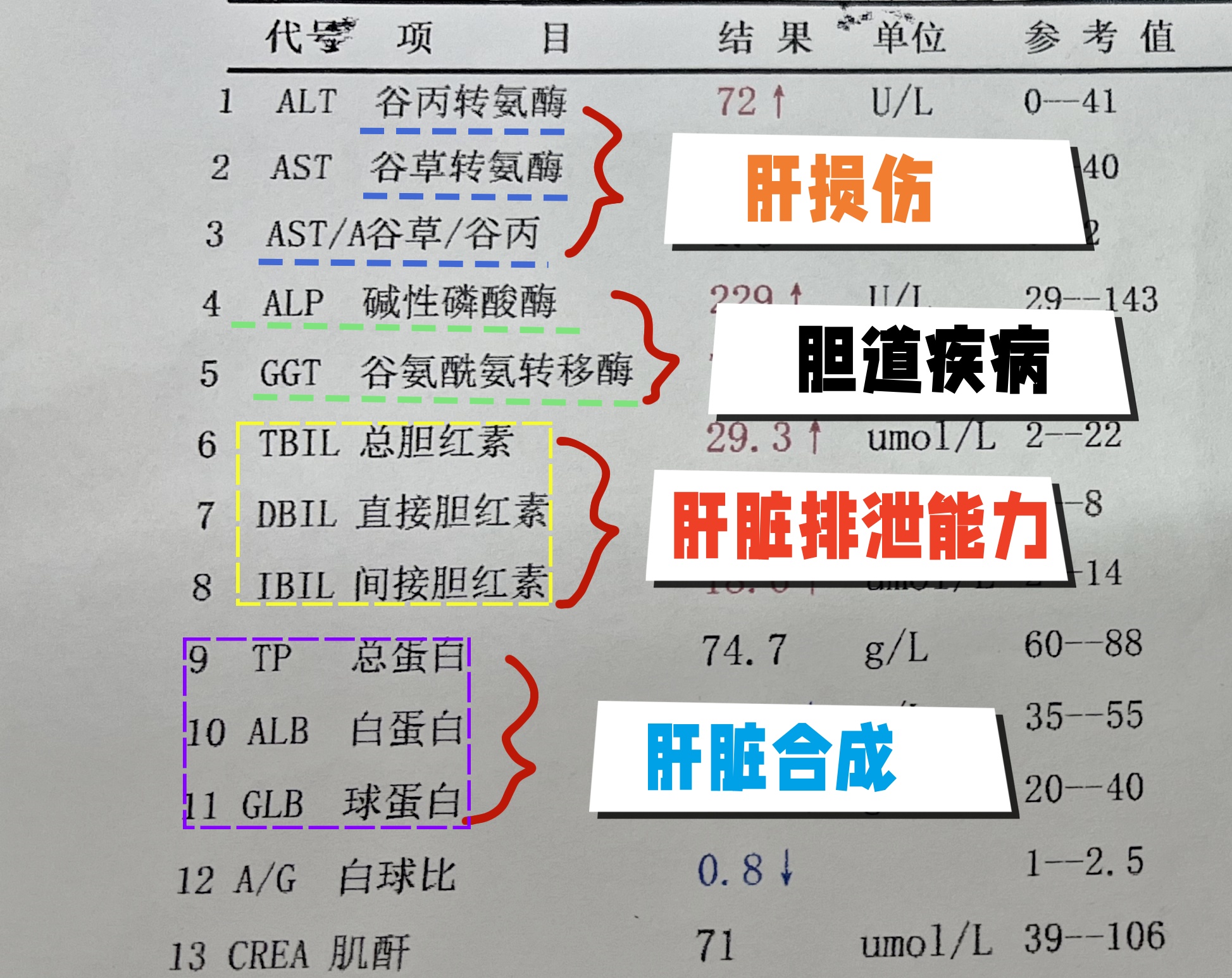 转氨酶肝功能常规5项几种肝病图片肝功能异常是怎么回事肝脏导致的