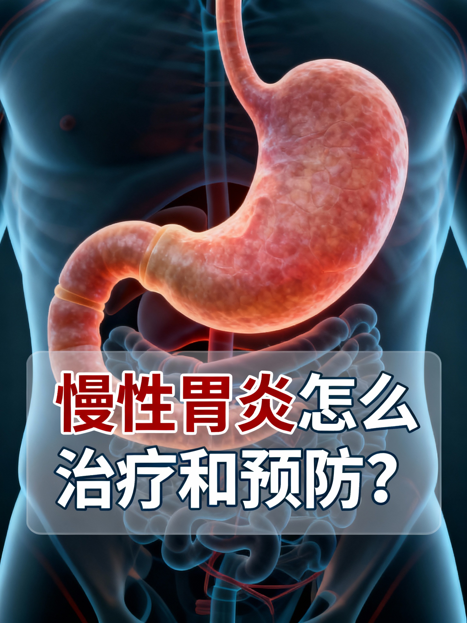 慢性胃炎如何治疗预防措施 慢性胃炎怎么治疗和预防?