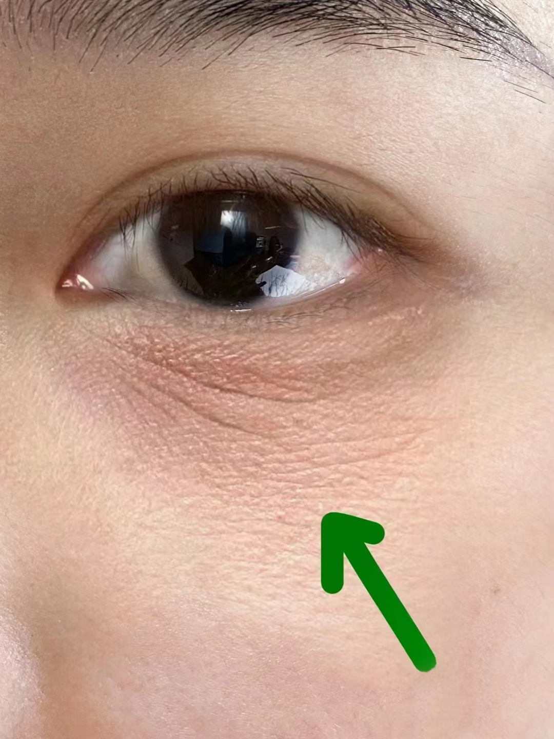 的烦恼,尤其是过了25岁后,胶原蛋白流失加快,眼周肌肤变得脆弱,细纹