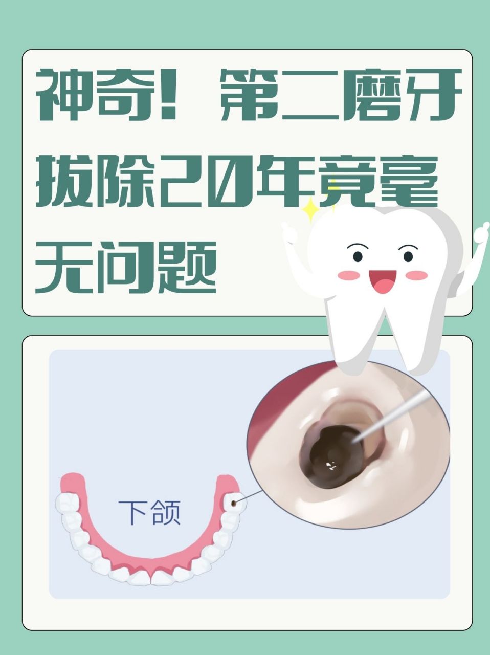 07   为什么有些人第二磨牙拔了20年都没事呢?