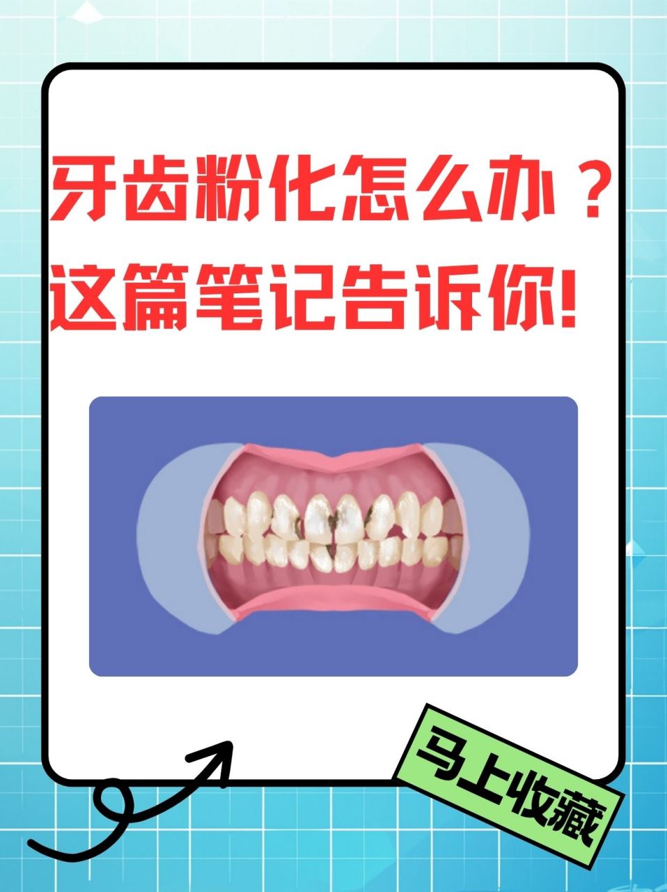 这篇笔记告诉你!   99697115牙齿粉化的表现93   1.