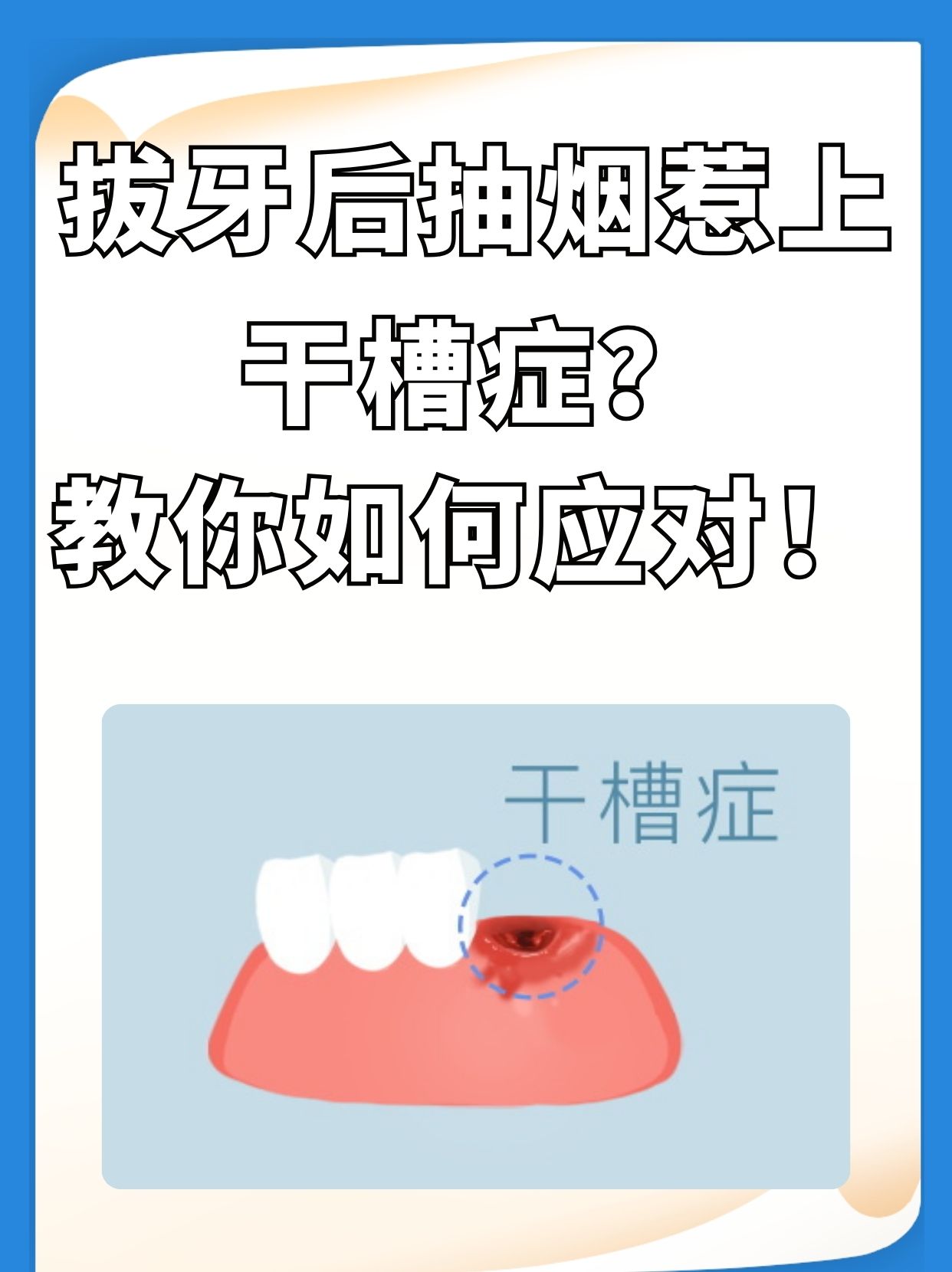 导致拔牙窝内空虚,细菌滋生,引发感染