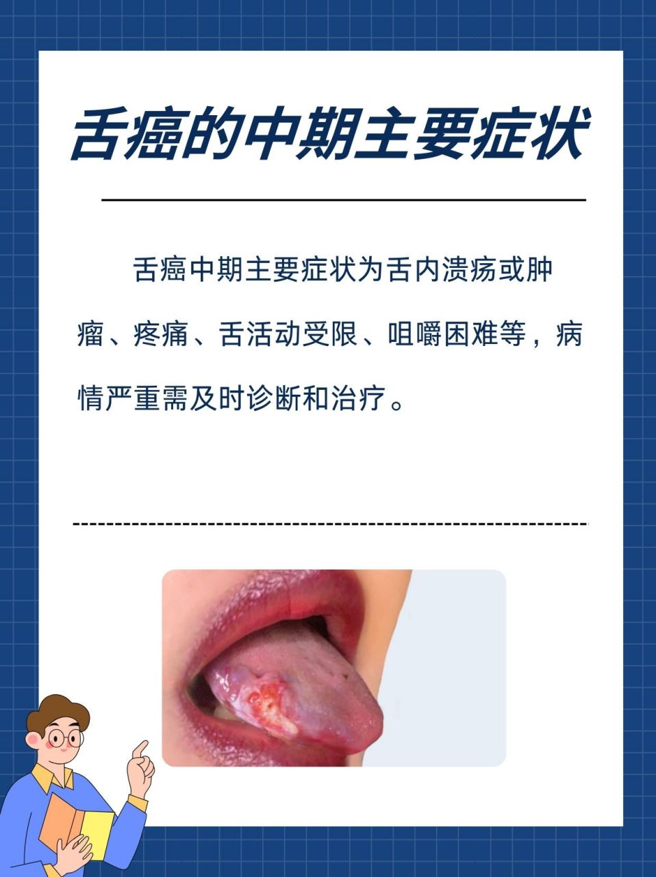 口腔癌舌头图片