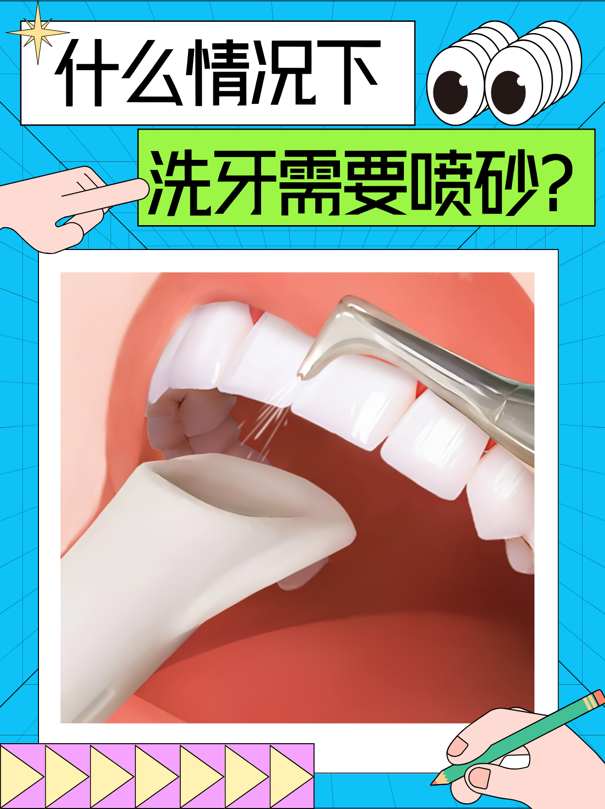 为什么有的洗牙需要喷砂?牙医为你揭晓背后真相!