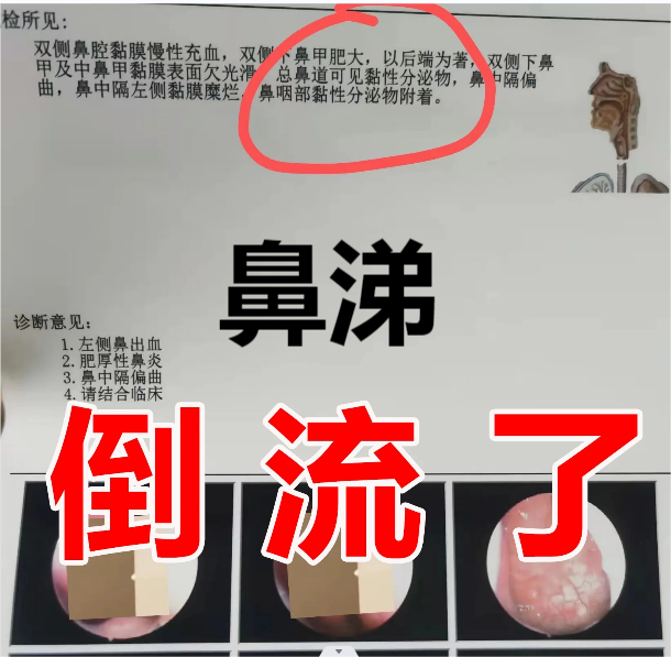 首先鼻涕倒流不是单独的病症,而是由鼻炎引起的并发症.