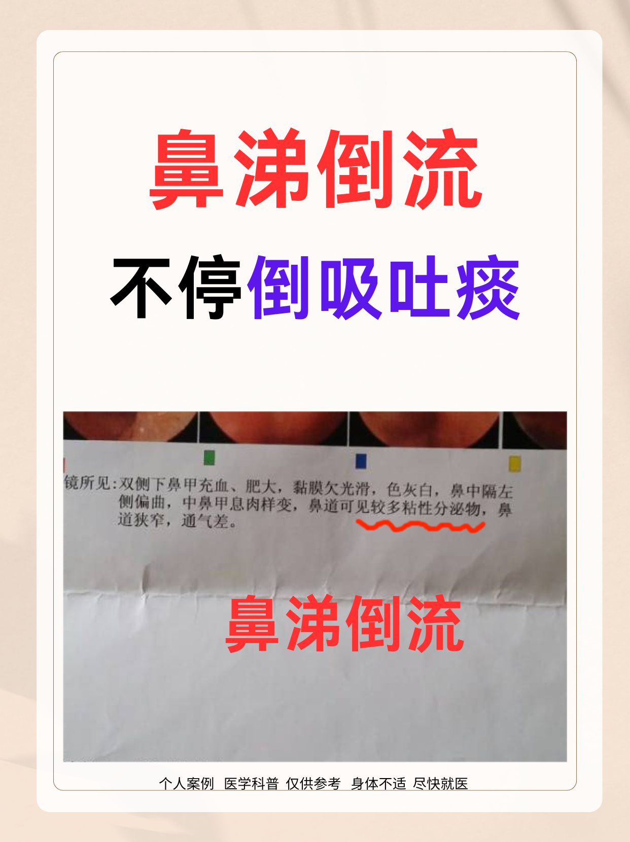 一上午的门诊下来,我看了九个鼻涕倒流的患者,其中七八个在倒流上都