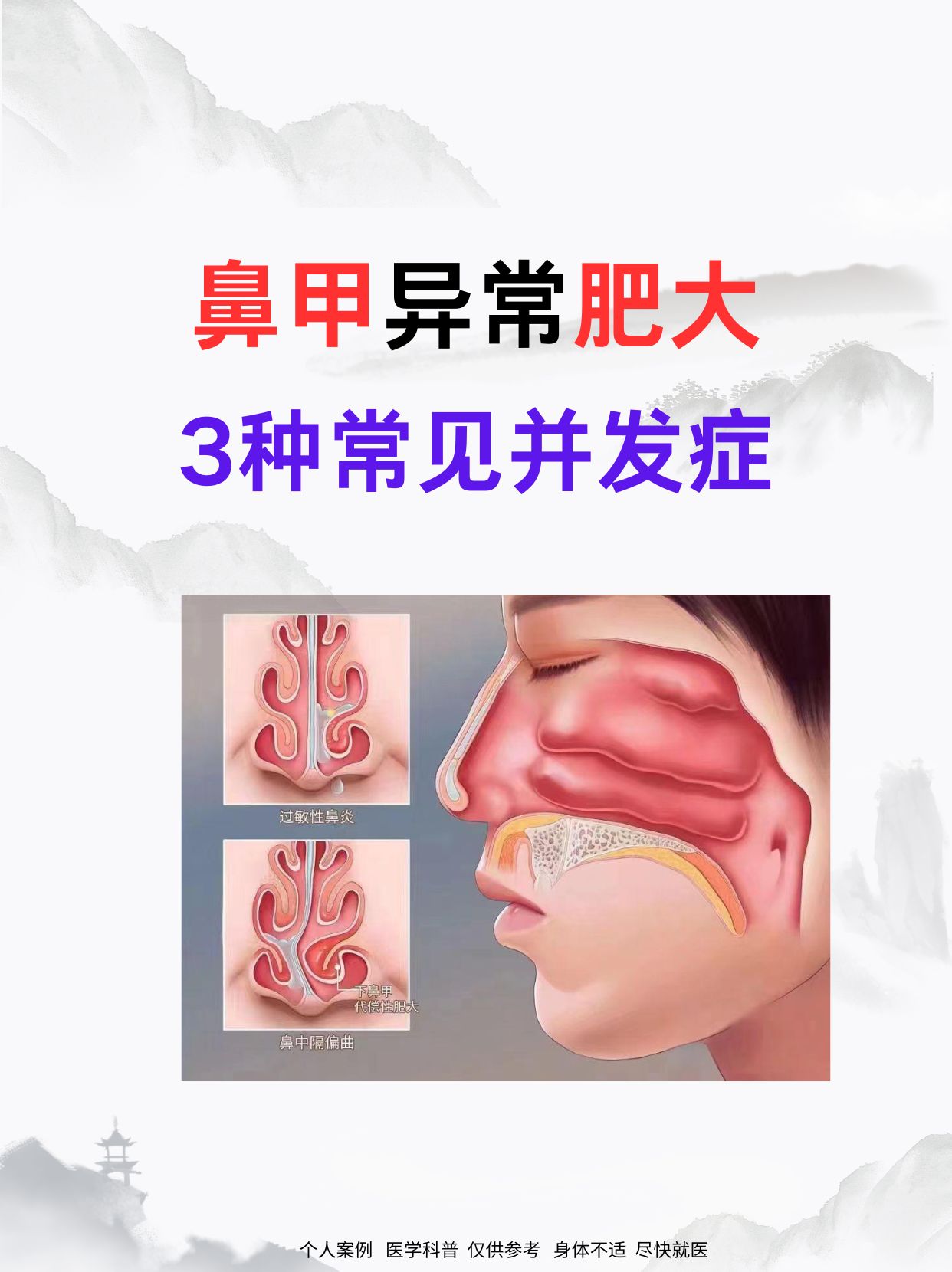 会产生3类常见并发症状,希望你一个都没有!