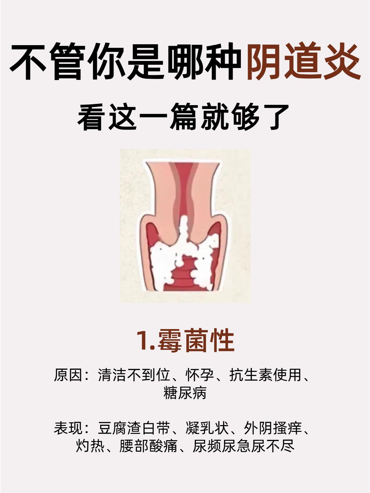关于妇科的知识,每个女生都需要看看 女性常见的妇科疾病,它可能由多