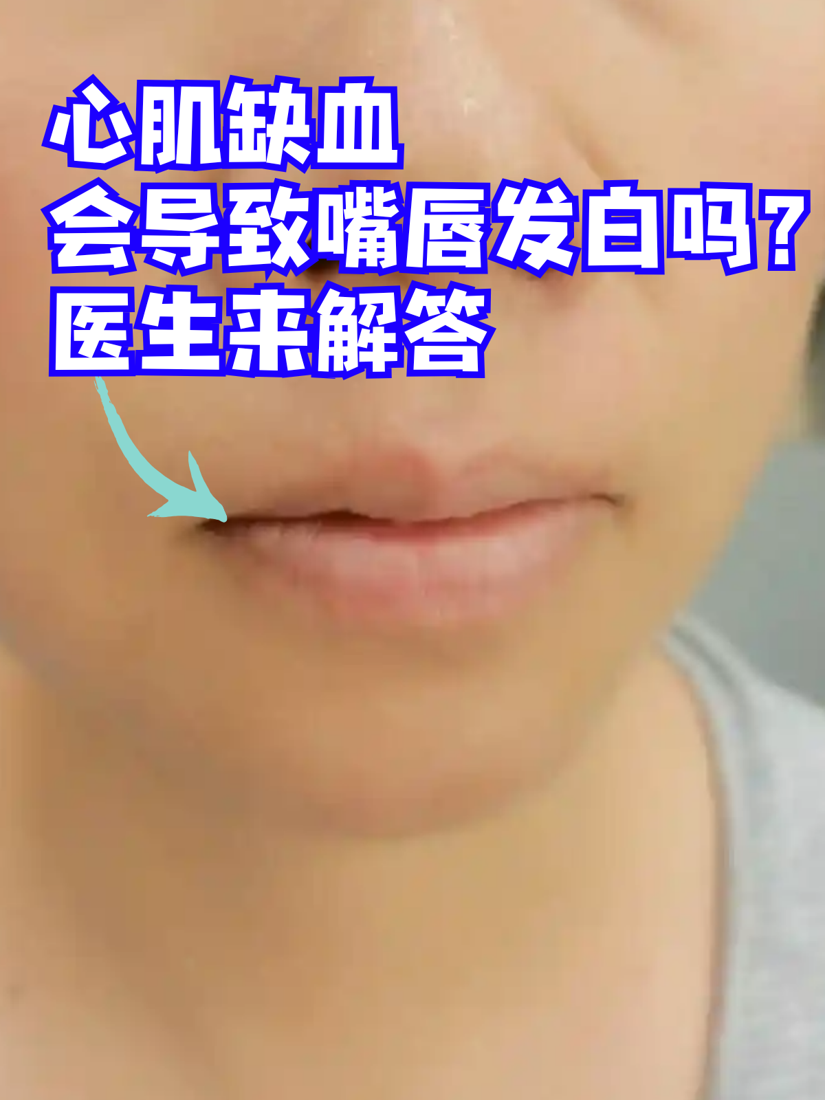 心肌缺血会导致嘴唇发白吗?