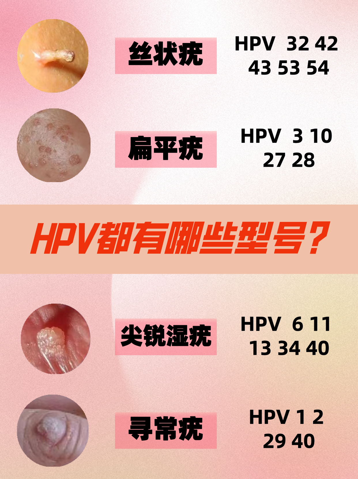 HPV是怎么感染的 早期图片