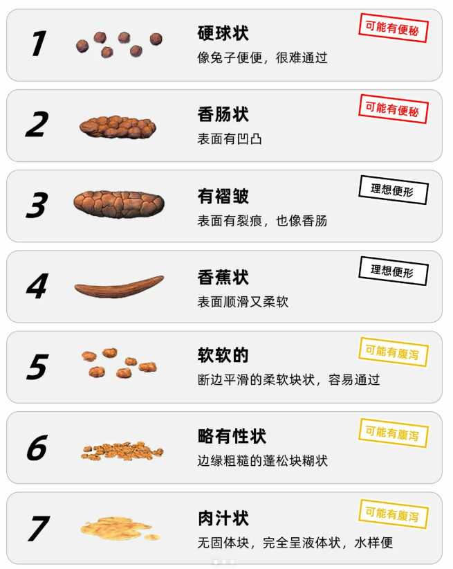 香蕉形状,表面光滑,较理想的便便形态 5型, 香蕉便便图片香蕉便大便