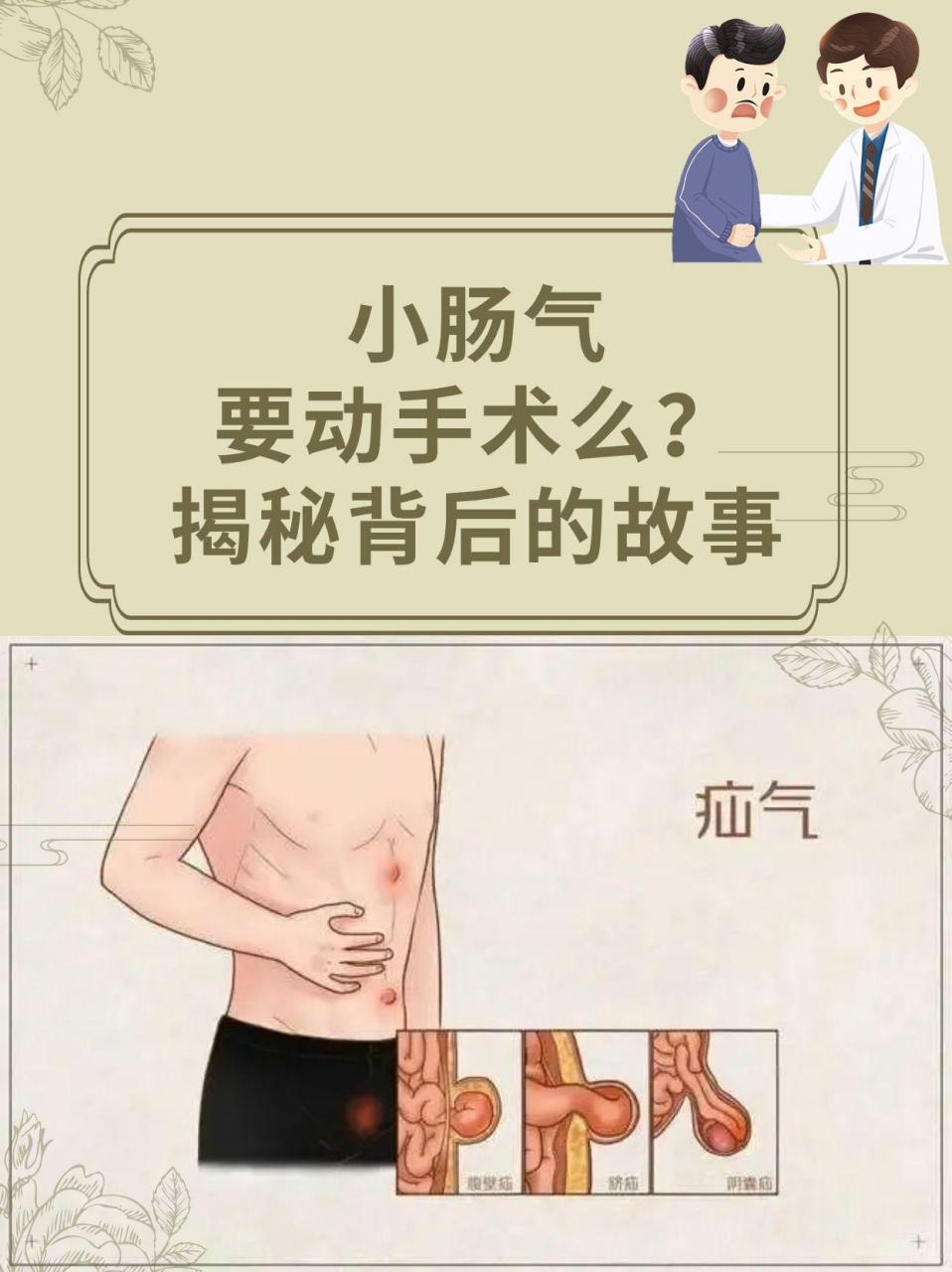 小肠气是什么病图片