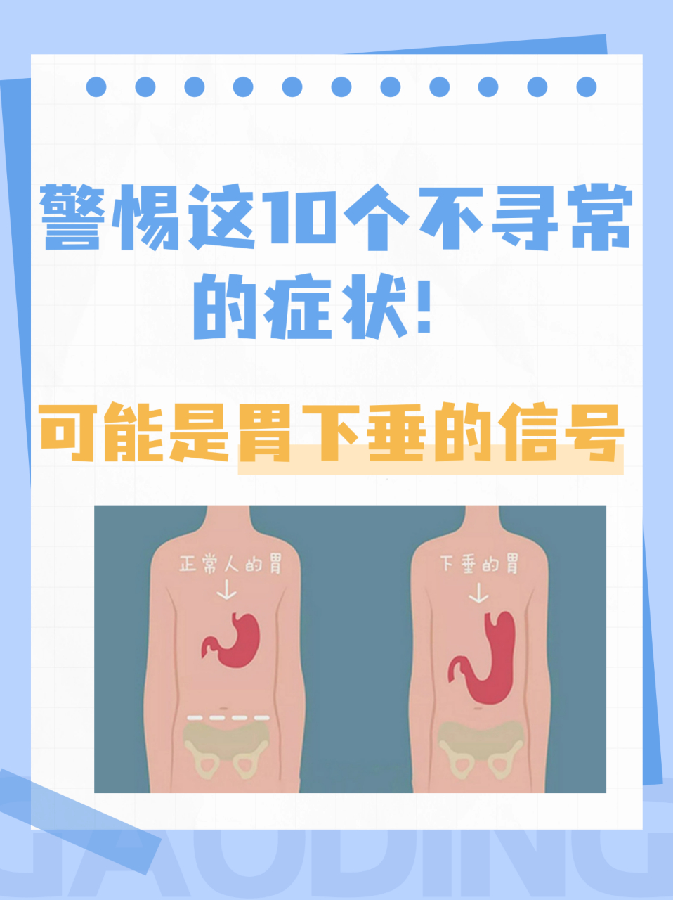 胃下垂作为一种常见的胃部问题,常常会通过一系列的症状表现出来