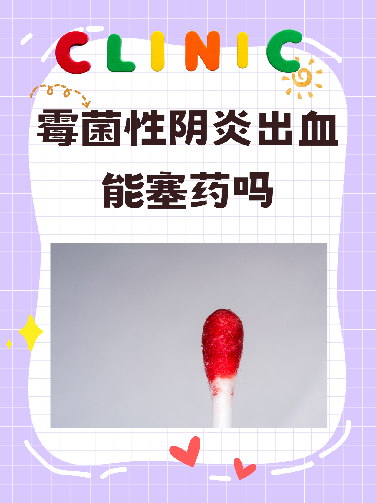 霉菌性阴炎出血的问题如同一个谜题,困扰着许多女性.