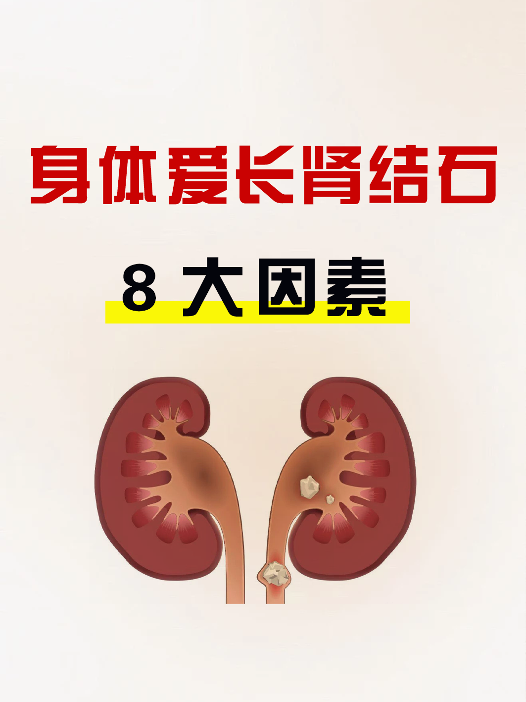 为什么会长肾结石 为什么会长肾结石