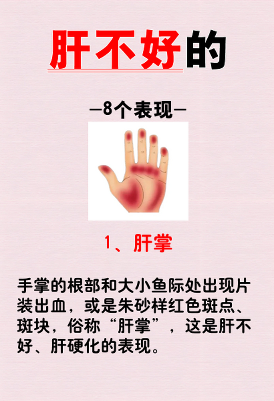 1.肝掌 2.晨尿黄 3.经常放屁 4.反复长痘 5.眼干脸黄 6.口干口臭 7.