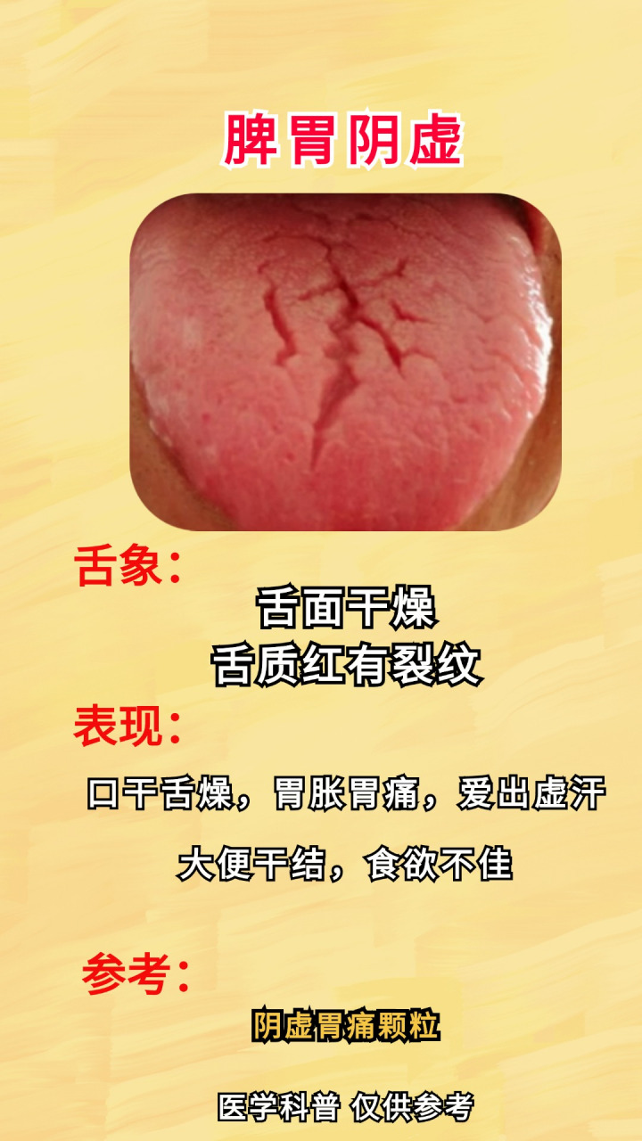脾胃虚弱  2.脾胃阴虚  3.