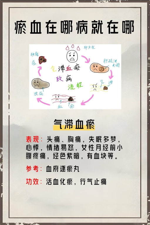 瘀血在哪病就在哪,分享4个中成药,给血管洗洗澡!