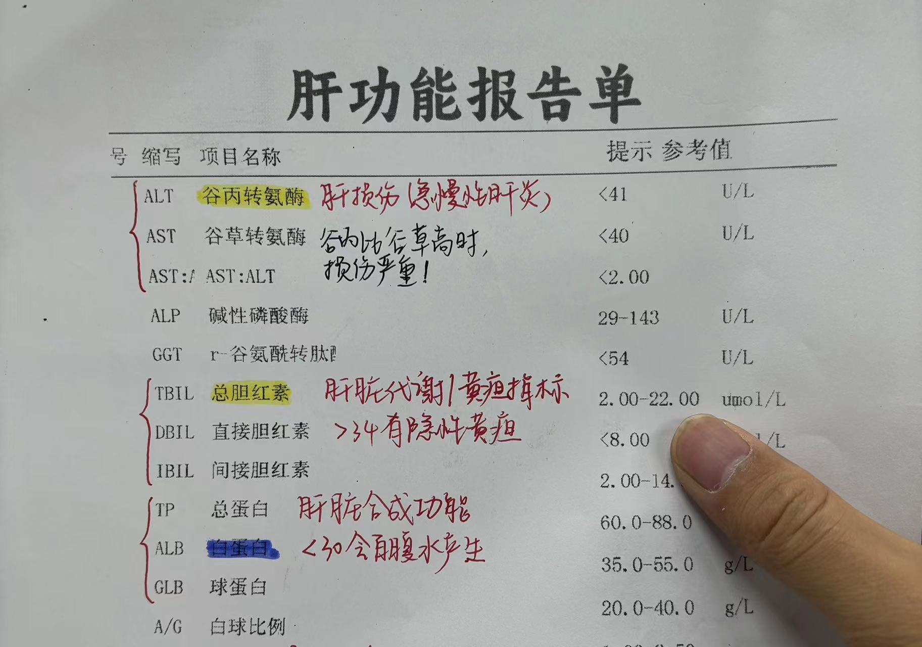 报告肝功能化验单图片正常肝功能化验单乙肝化验单乙肝五项正确对照表
