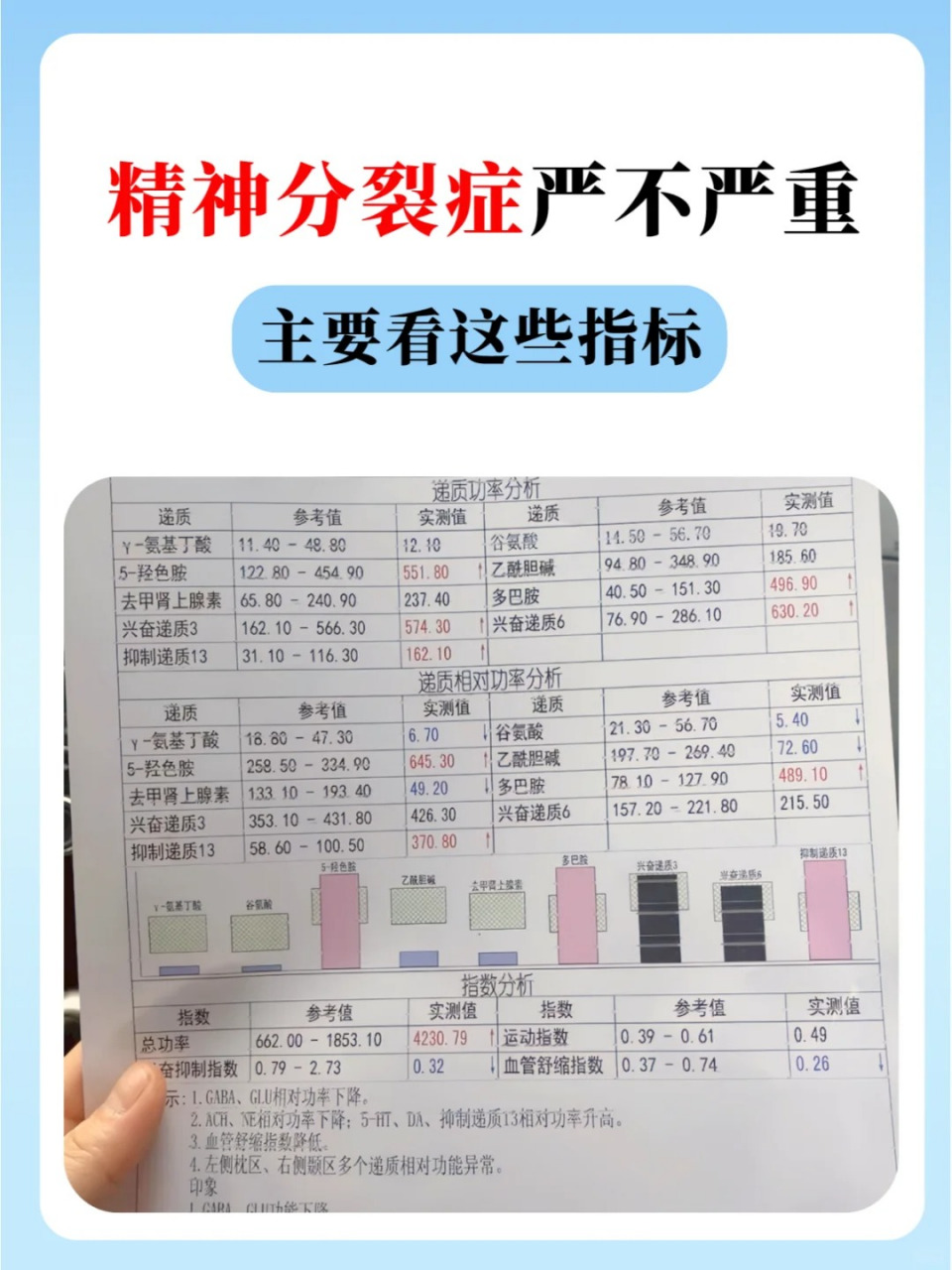 精神分列症等级二级严重吗(精神分列症一级和二级的区别)