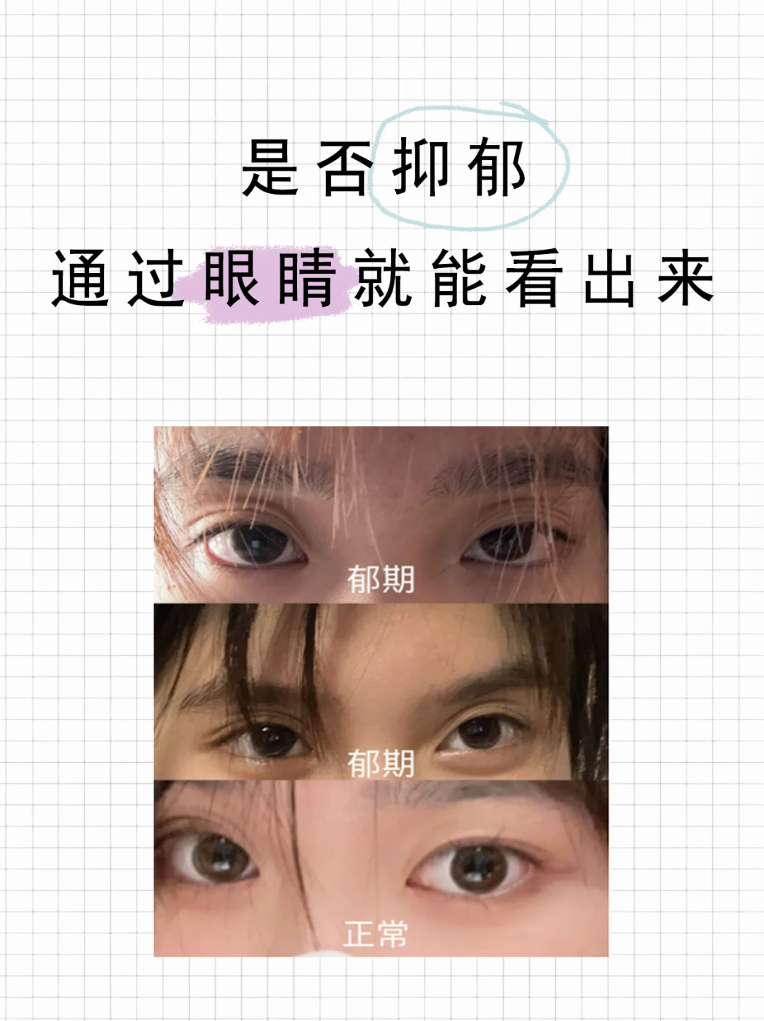 是不是抑郁症,一看眼睛就知道!