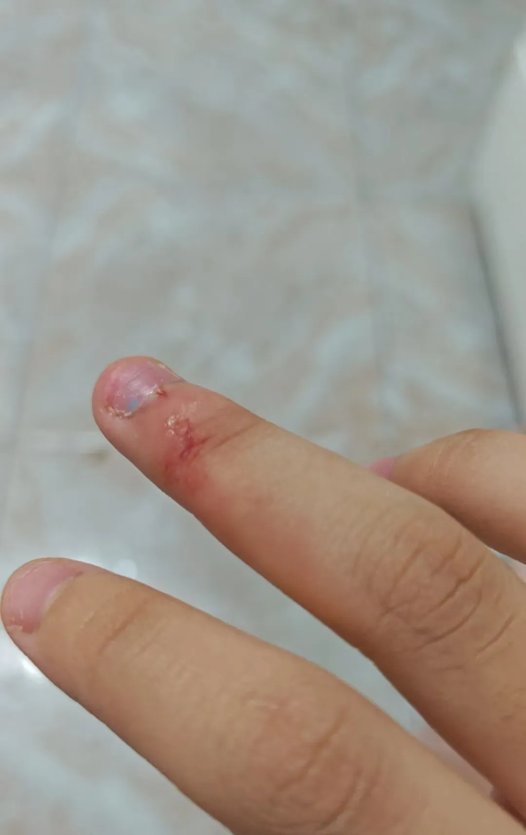 我家的柯基差几天三岁已经送走了,今天又咬我一口,一次咬我手指伤得很