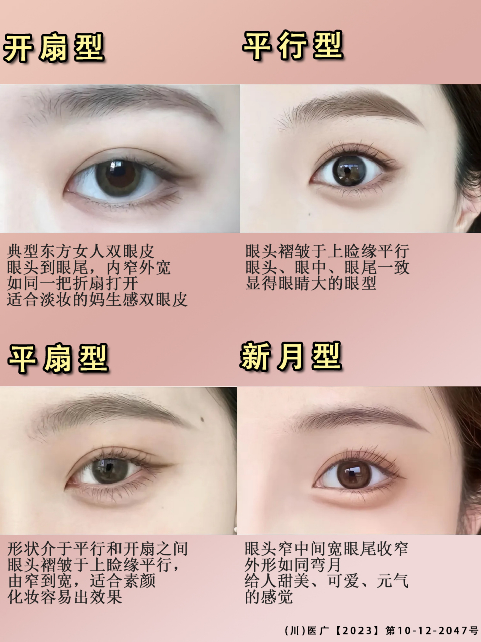 **平行型**: - 双眼皮线与睫毛根部平行