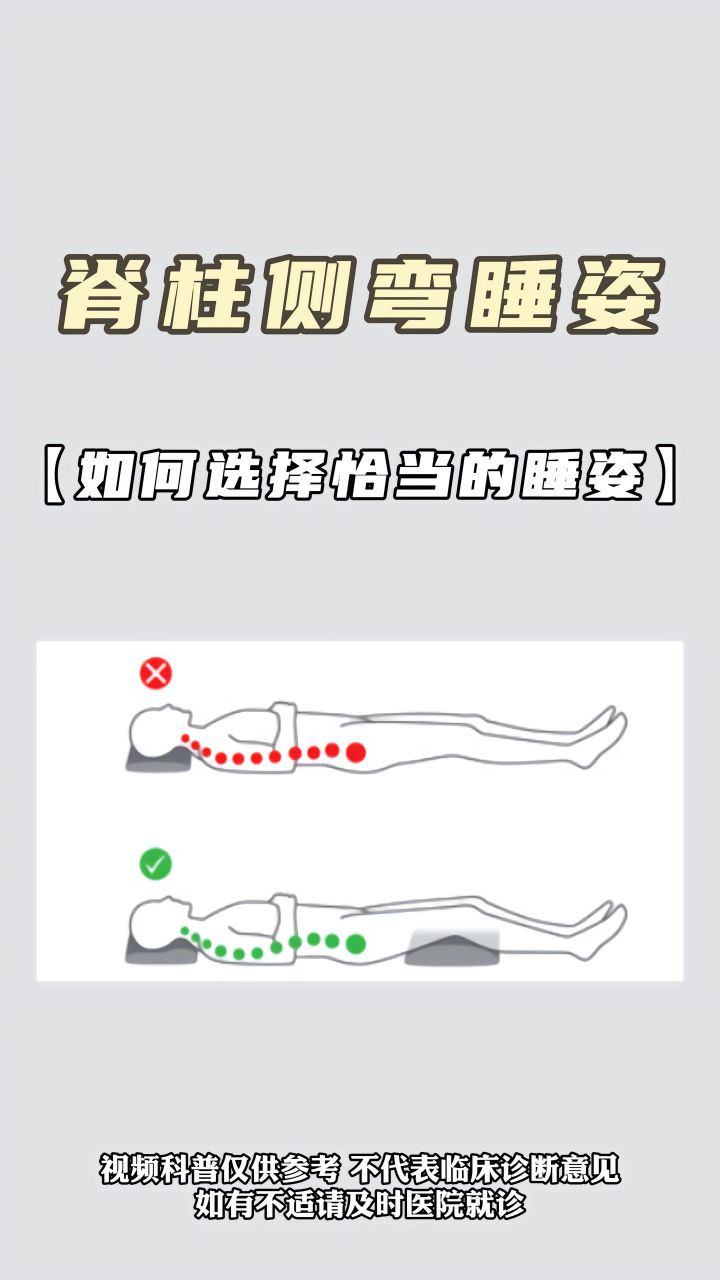 棘上韧带炎睡觉姿势图片