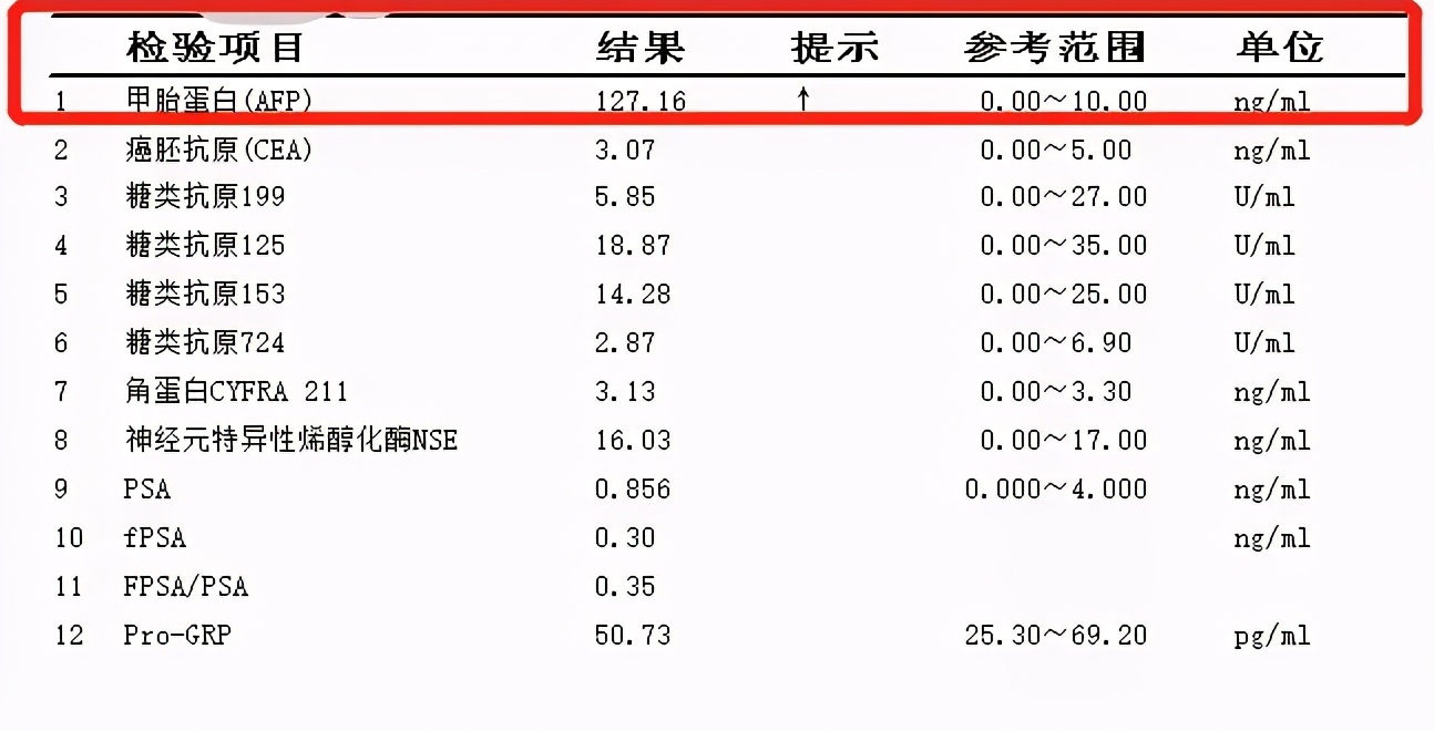 甲胎蛋白怎么检查图片