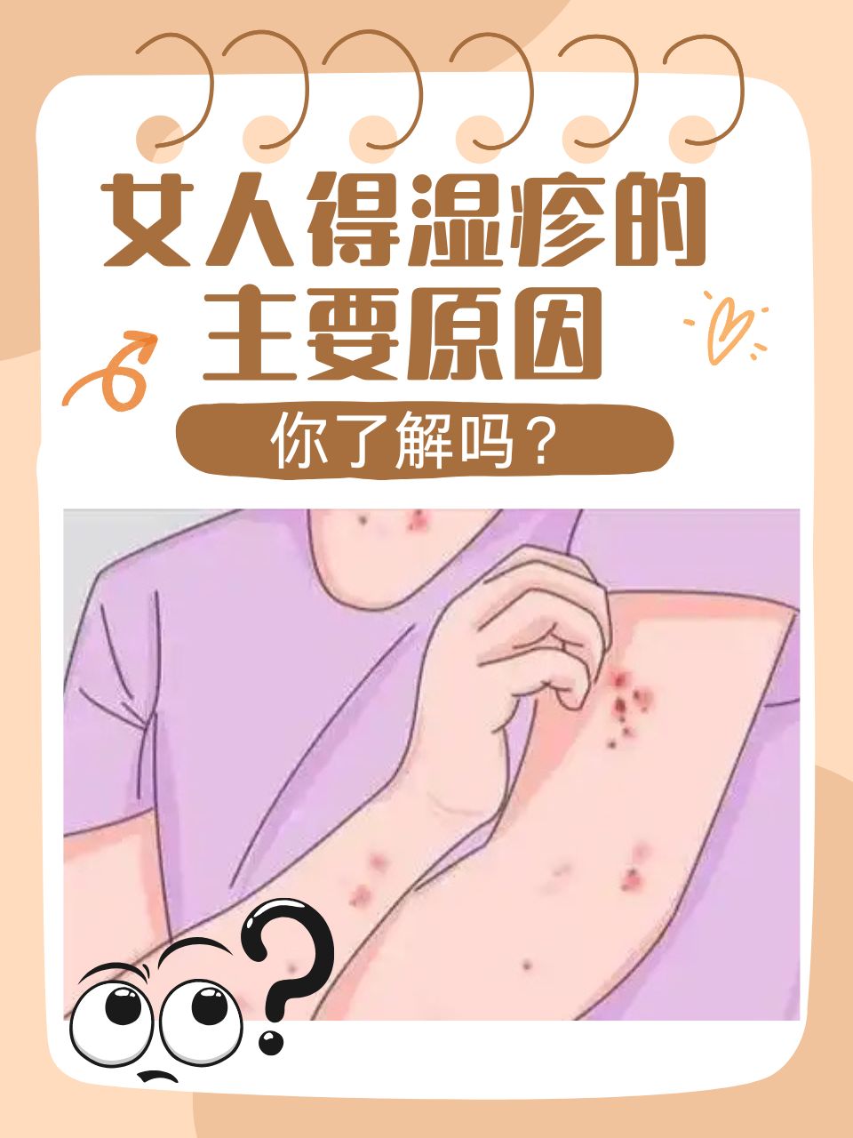 为什么得湿疹 为什么得湿疹