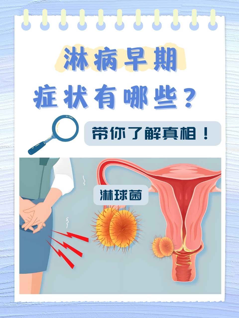 淋病是一种由淋病奈瑟菌(简称淋球菌)引起的以泌尿生殖系统化脓性