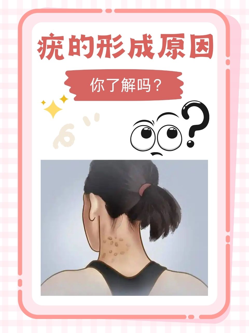 人身上为什么会长瘊子